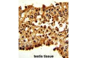 Immunohistochemistry (IHC) image for anti-Pituitary Tumor-Transforming 1 (PTTG1) antibody (ABIN3003161) (PTTG1 抗体)