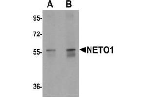 Western blot analysis of NETO1 in human lung tissue lysate with NETO1 Antibody  at (A) 1 and (B) 2 μg/mL. (NETO1 抗体  (C-Term))