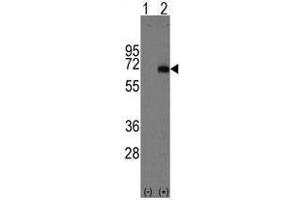 Image no. 1 for anti-alpha-Fetoprotein (AFP) (Center) antibody (ABIN356915) (alpha Fetoprotein 抗体  (Center))