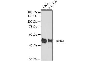 Western blot analysis of extracts of various cell lines, using RING1A Rabbit mAb (ABIN7270051) at 1:1000 dilution. (RING1 抗体)