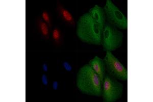 ABIN6264049 and ABIN6266617 staining  cells by IF/ICC. (PAX5 抗体  (N-Term))
