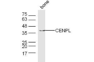 Mouse bone lysates probed with CENPL Polyclonal Antibody, Unconjugated  at 1:300 dilution and 4˚C overnight incubation. (CENPL 抗体  (AA 51-150))