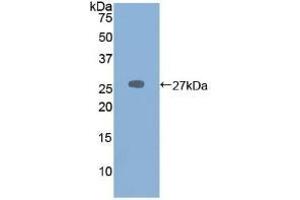Detection of Recombinant PRSS2, Mouse using Polyclonal Antibody to Protease, Serine 2 (PRSS2) (PRSS2 抗体  (AA 29-240))