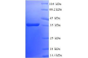 SDS-PAGE (SDS) image for BCL2-Like 2 (BCL2L2) (AA 2-193) protein (His-SUMO Tag) (ABIN5711533) (BCL2L2 Protein (AA 2-193) (His-SUMO Tag))
