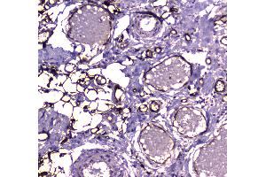 IHC analysis of FABP5 using anti-FABP5 antibody . (FABP5 抗体)