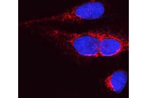 IF analysis of OPA1 using anti-OPA1 antibody (ABIN3043457).