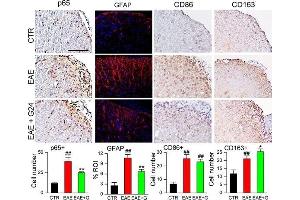 Immunohistochemistry (Paraffin-embedded Sections) (IHC (p)) image for anti-CD86 (CD86) (AA 140-175) antibody (ABIN736701)