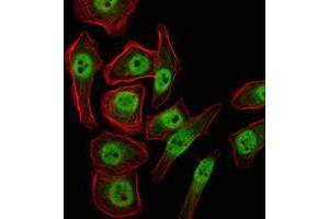 Immunofluorescence analysis of NTERA-2 cells using KDM4A mouse mAb (green). (KDM4A 抗体)