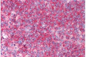 Human Spleen (formalin-fixed, paraffin-embedded) stained with CD82 antibody ABIN213919 at 0. (CD82 抗体  (C-Term))