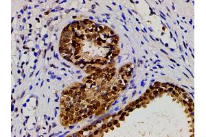 Immunohistochemistry (IHC) image for anti-Cofilin 1 (CFL1) (pSer3) antibody (ABIN6255180)