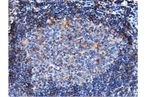 Immunohistochemistry (IHC) image for anti-rho GTPase Activating Protein 25 (ARHGAP25) antibody (ABIN1496701) (ARHGAP25 抗体)