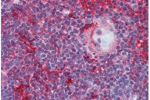 Human Thymus (formalin-fixed, paraffin-embedded) stained with LCK antibody ABIN296046 at 5 ug/ml followed by biotinylated anti-mouse IgG secondary antibody ABIN481714, alkaline phosphatase-streptavidin and chromogen. (LCK 抗体)