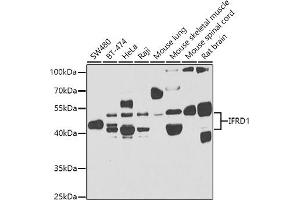 Western blot analysis of extracts of various cell lines, using IFRD1 antibody (ABIN6129279, ABIN6142215, ABIN6142217 and ABIN6223314) at 1:1000 dilution.