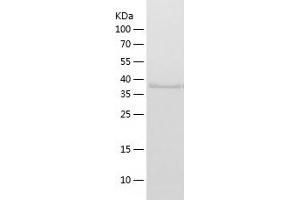 Western Blotting (WB) image for Hydroxymethylbilane Synthase (HMBS) (AA 1-361) protein (His tag) (ABIN7285148) (HMBS Protein (AA 1-361) (His tag))