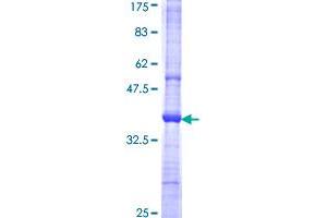 CD1c Protein (AA 77-185) (GST tag)