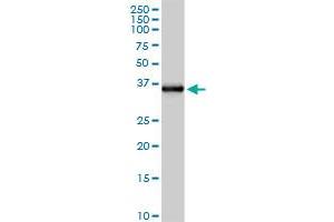 FCN2 MaxPab rabbit polyclonal antibody. (Ficolin 2 抗体  (AA 1-313))