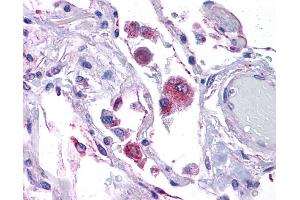 KITLG antibody was used for immunohistochemistry at a concentration of 4-8 ug/ml. (KIT Ligand 抗体  (Middle Region))
