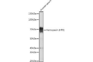 Western blot analysis of extracts of Human serum, using Hemopexin (HPX) (HPX) Rabbit mAb (ABIN7267611) at 1:5000 dilution. (Hemopexin 抗体)