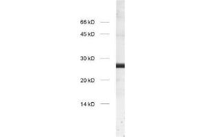 dilution: 1 : 1000, sample: crude synaptosomal fraction of rat brain (P2) (GS28 抗体  (Cytoplasmic Domain))