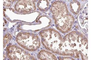 ABIN6267002 at 1/100 staining human kidney tissue sections by IHC-P. (MRRF 抗体  (Internal Region))