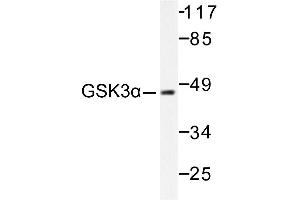 Image no. 1 for anti-Glycogen Synthase Kinase 3 alpha (GSK3a) antibody (ABIN265449) (GSK3 alpha 抗体)