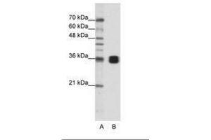 Image no. 1 for anti-Heterogeneous Nuclear Ribonucleoprotein A0 (HNRNPA0) (AA 154-203) antibody (ABIN202208) (HNRNPA0 抗体  (AA 154-203))