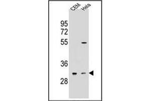 Western blot analysis of OR5L2 Antibody (N-term) in CEM,Hela cell line lysates (35ug/lane). (OR5L2 抗体  (N-Term))