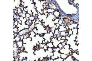 IHC analysis of ACE using anti-ACE antibody (ABIN3043777). (Angiotensin I Converting Enzyme 1 抗体  (AA 651-864))