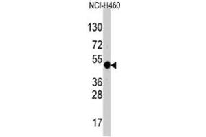 Western blot analysis of TFAP2A polyclonal antibody  in NCI-H460 cell line lysates (35 ug/lane).