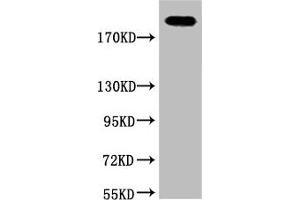 Western blot analysis of Hela, diluted at 1:2000. (Fibronectin 1 抗体)