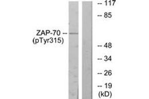 Western blot analysis of extracts from Jurkat cells treated with Ca+ 40nM 30', using ZAP-70 (Phospho-Tyr315) Antibody. (ZAP70 抗体  (pTyr315))