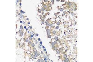 Immunohistochemistry of paraffin-embedded rat testis using  antibody  at dilution of 1:100 (40x lens). (ASZ1 抗体  (AA 1-350))