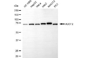 anti-ATP-Binding Cassette, Sub-Family F (GCN20), Member 2 (ABCF2) antibody