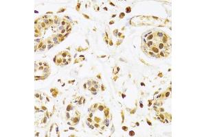 Immunohistochemistry of paraffin-embedded human breast using SEPHS1 Antibody (ABIN5973853) at dilution of 1/100 (40x lens). (SEPHS1 抗体)