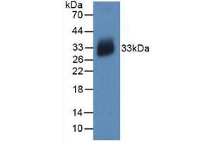 Detection of Recombinant IL12A, Human using Monoclonal Antibody to Interleukin 12A (IL12A) (IL12A 抗体  (AA 23-219))