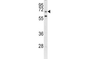 Western blot analysis of GARP antibody and CEM lysate. (LRRC32 抗体  (AA 234-260))