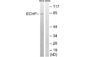 Immunohistochemistry analysis of paraffin-embedded human breast carcinoma tissue using EHHADH antibody.