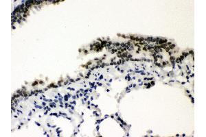Immunohistochemistry (Paraffin-embedded Sections) (IHC (p)) image for anti-Sp3 Transcription Factor (Sp3) (AA 569-599), (C-Term) antibody (ABIN3043350) (Sp3 抗体  (C-Term))
