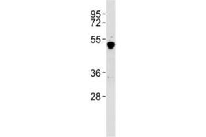Western blot testing of GATA2 antibody at 1:2000 dilution + K562 lysate. (GATA2 抗体  (C-Term))
