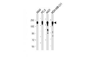 All lanes : Anti-EGFR Antibody (C-term) at 1:8000 dilution Lane 1: A549 whole cell lysate Lane 2: PC-3 whole cell lysate Lane 3: A431 whole cell lysate Lane 4: MDA-MB-231 whole cell lysate Lysates/proteins at 20 μg per lane.
