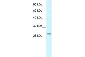 Western Blotting (WB) image for anti-Zinc Finger, AN1-Type Domain 6 (ZFAND6) (Middle Region) antibody (ABIN2775809)