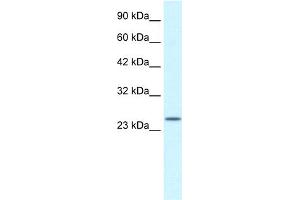 WB Suggested Anti-ZA20D3 Antibody Titration:  2. (ZFAND6 抗体  (Middle Region))