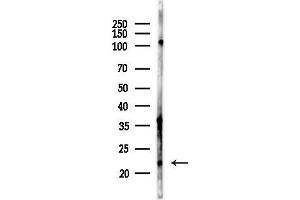 Western blot analysis of lysates from Mouse liver, using IMMP2L Antibody at 1/1000 dilution.