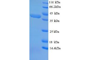 SPEG Protein (AA 1-113, partial) (GST tag)