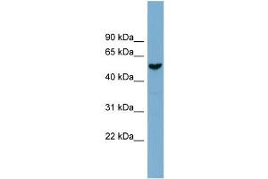 WB Suggested Anti-FAM83E  Antibody Titration: 0. (FAM83E 抗体  (Middle Region))