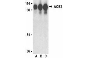 Western blot analysis of ACE2 in human kidney lysate with AP30006PU-N ACE2 antibody at (A) 0. (ACE2 抗体  (Intermediate Domain 1))