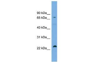 WB Suggested Anti-SPG20  Antibody Titration: 0. (SPG20 抗体  (Middle Region))