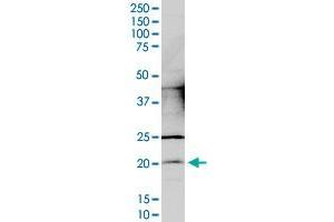 CCDC12 monoclonal antibody (M05), clone 7B1. (CCDC12 抗体  (AA 1-166))