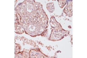 Immunohistochemistry (IHC) image for anti-ATP Synthase, H+ Transporting, Mitochondrial F1 Complex, gamma Polypeptide 1 (ATP5C1) (AA 26-298) antibody (ABIN7265723)