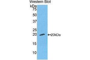 Figure. (ENPP1 抗体  (Biotin))